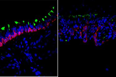 Microscopic image showing stem cells in young (left) and old (right) airways with cell nuclei seen in blue, airway basal stem cells seen in red and ciliated cells seen in green.