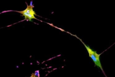 The developed AI algorithm can transform a brightfield image into a fluorescent-like image without sacrificing the cells to obtain.