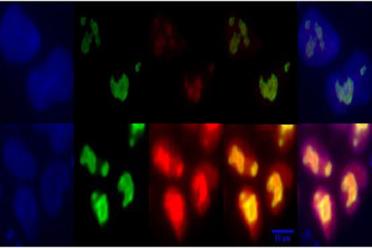 Colorful staining indicates higher levels of a key sugar metabolism regulator in naïve (bottom row) versus primed (top row) human embryonic stem cells.