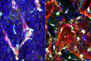 Expression of pleiotrophin (green) in bone marrow blood vessels (red) and stromal cells (white) is shown in normal mice (left) and in mice at 24 hours following irradiation (right).