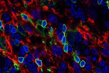 A section of an artificial thymic organoid showing T cells (outlined in green) created from blood stem cells. | UCLA Broad Stem Cell Research Center/Cell Reports