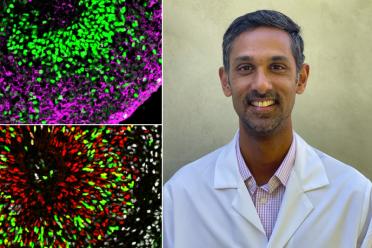 Microscope images of stem cell-derived organoids replicating different parts of the human brain. Dr. Ranmal Samarasinghe