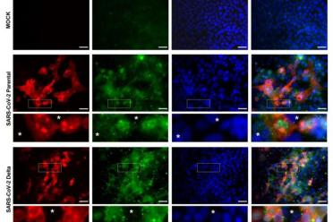 This chart shows levels of SARS-CoV-2 and deactivated YAP (pYAP127) in healthy cultured cells (mock) and cultured cells infected with the original strain of COVID-19 (SARS-CoV-2 Parental) and the Delta strain (SARS-CoV-2 Delta). Asterisks in the insets indicate uninfected cells.