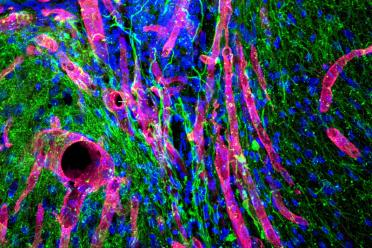 A photomicrograph showing new tissue growing in the stroke cavity in a mouse. Red tubes are blood vessels; green filaments are nerve fibers.