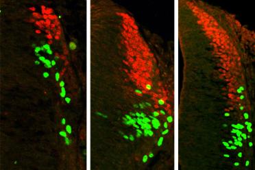 Increasing the concentration of a certain type of BMP increases the production of the same categories of sensory interneurons (red and green). Left: no BMP added; center: 1x BMP added; right: 10x BMP added.