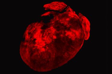 A mouse heart with cardiomyocytes dissolved, leaving a 3-D scaffold of cardiac fibroblasts. Concentrated areas of red represent post-heart attack aggregation of cardiac fibroblasts.