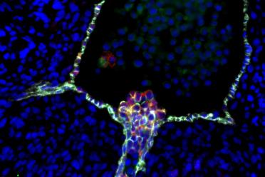 Human blood stem cells emerging from specialized endothelial cells in the wall of an embryonic aorta. UCLA scientists’ confirmation of this process clarifies a longstanding controversy about the stem cells’ cellular origin. 