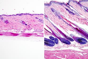 Untreated mouse skin showing no hair growth (left) compared to mouse skin treated with the drug UK5099 (right) showing hair growth. 