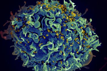 A human T cell, in blue, under attack by HIV, in yellow.