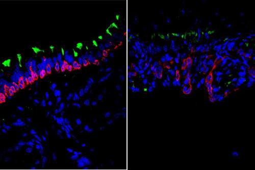 Microscopic image showing stem cells in young (left) and old (right) airways with cell nuclei seen in blue, airway basal stem cells seen in red and ciliated cells seen in green