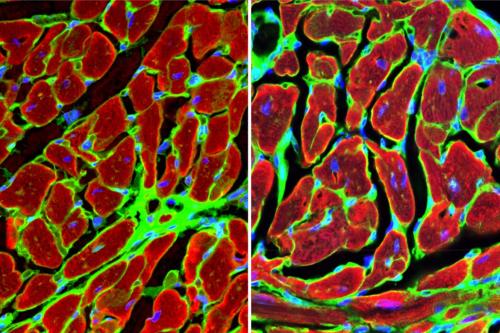 Microscopy image: Heart muscle cells surrounding the damaged tissue after a heart attack.