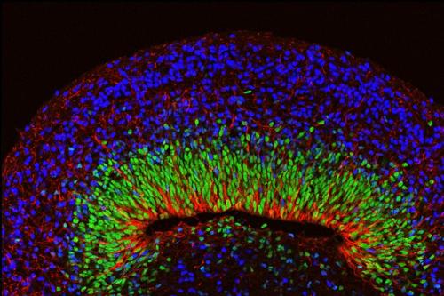 A microscope image of a mini brain organoid showing layered neural tissue and different types of neural cells