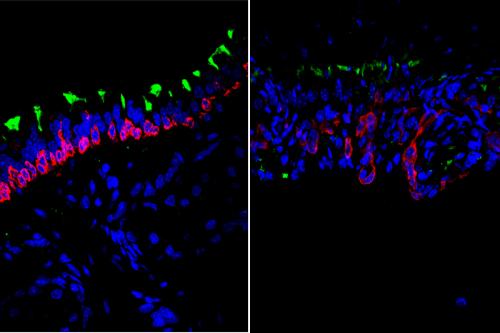 Microscopic image showing stem cells in young (left) and old (right) airways with cell nuclei seen in blue, airway basal stem cells seen in red and ciliated cells seen in green.