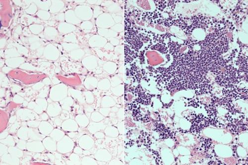 Bone marrow showing a loss of blood cells in mice after radiation (left) and then after treatment with the PTP-sigma inhibitor (right), where the recovery of blood cells is visible.