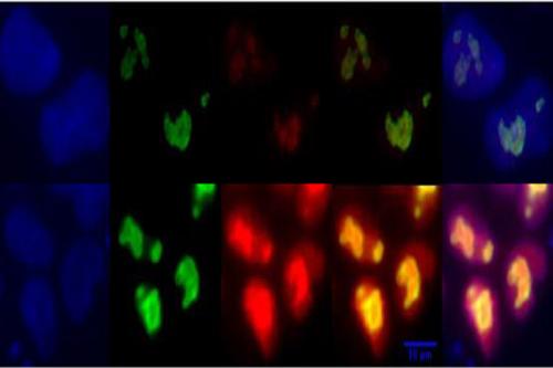 Colorful staining indicates higher levels of a key sugar metabolism regulator in naïve (bottom row) versus primed (top row) human embryonic stem cells.