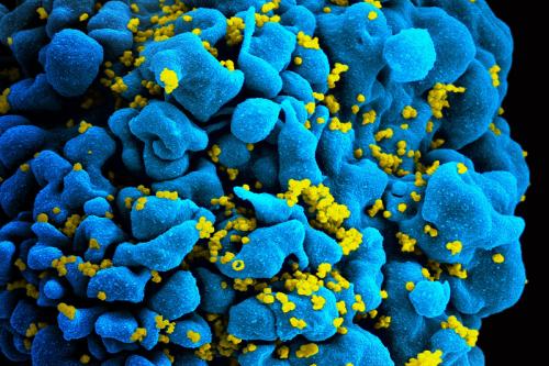 Researchers will focus on an immunotherapy known as CAR T, which uses genetically modified stem cells to target and destroy HIV-infected cells like this one. 