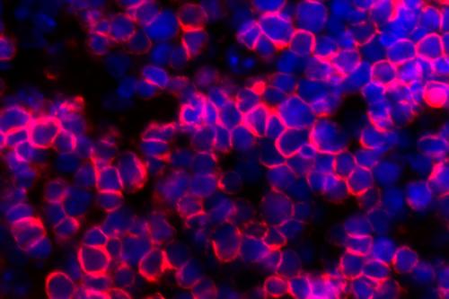 T cells (red) produced using artificial thymic organoids developed at UCLA.