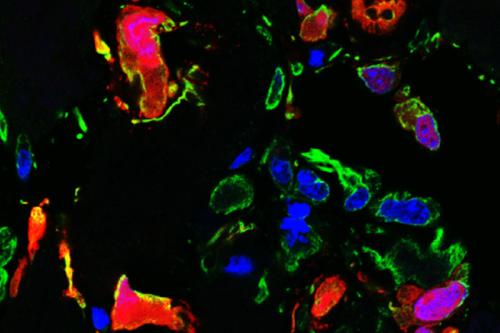 Microscope image of cardiac calcification in a mouse showing cardiac fibroblasts (red) expressing the ENPP1 protein (green and yellow)