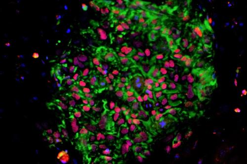 A colony of human induced pluripotent stem cells