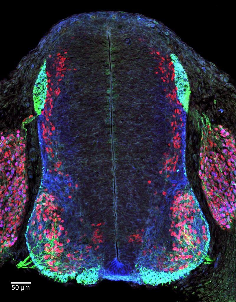 2019 Third Place Microscopy Contest