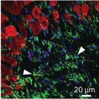 Microscopy image: Cardiac muscle shown in red and ENPP1 in green demonstrates expression of ENPP1 in the region of scar formation.